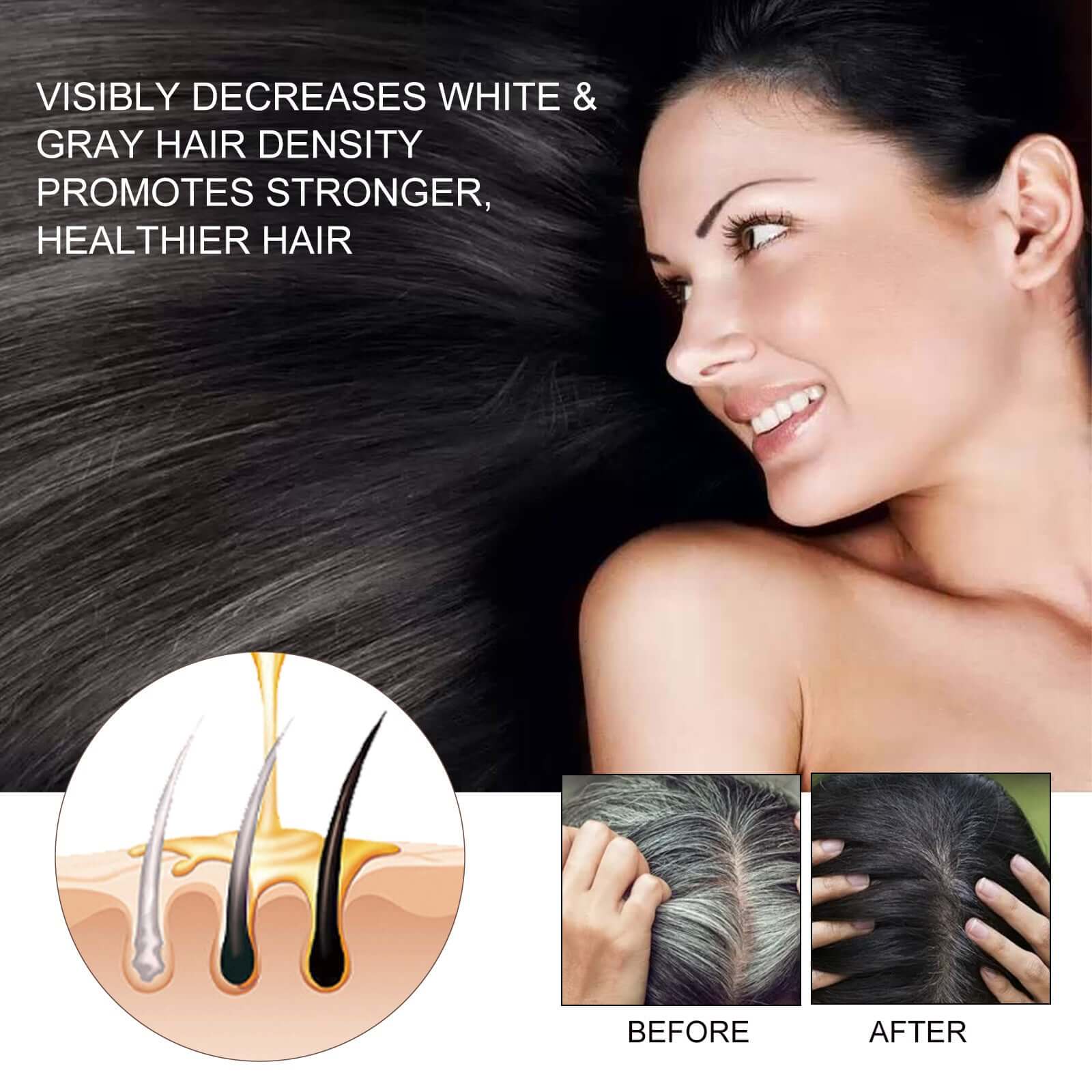 EELHOE Hair Dense Essence Hair Anti-hair Loss And Hair Fixation Nutrition - Novair-product name