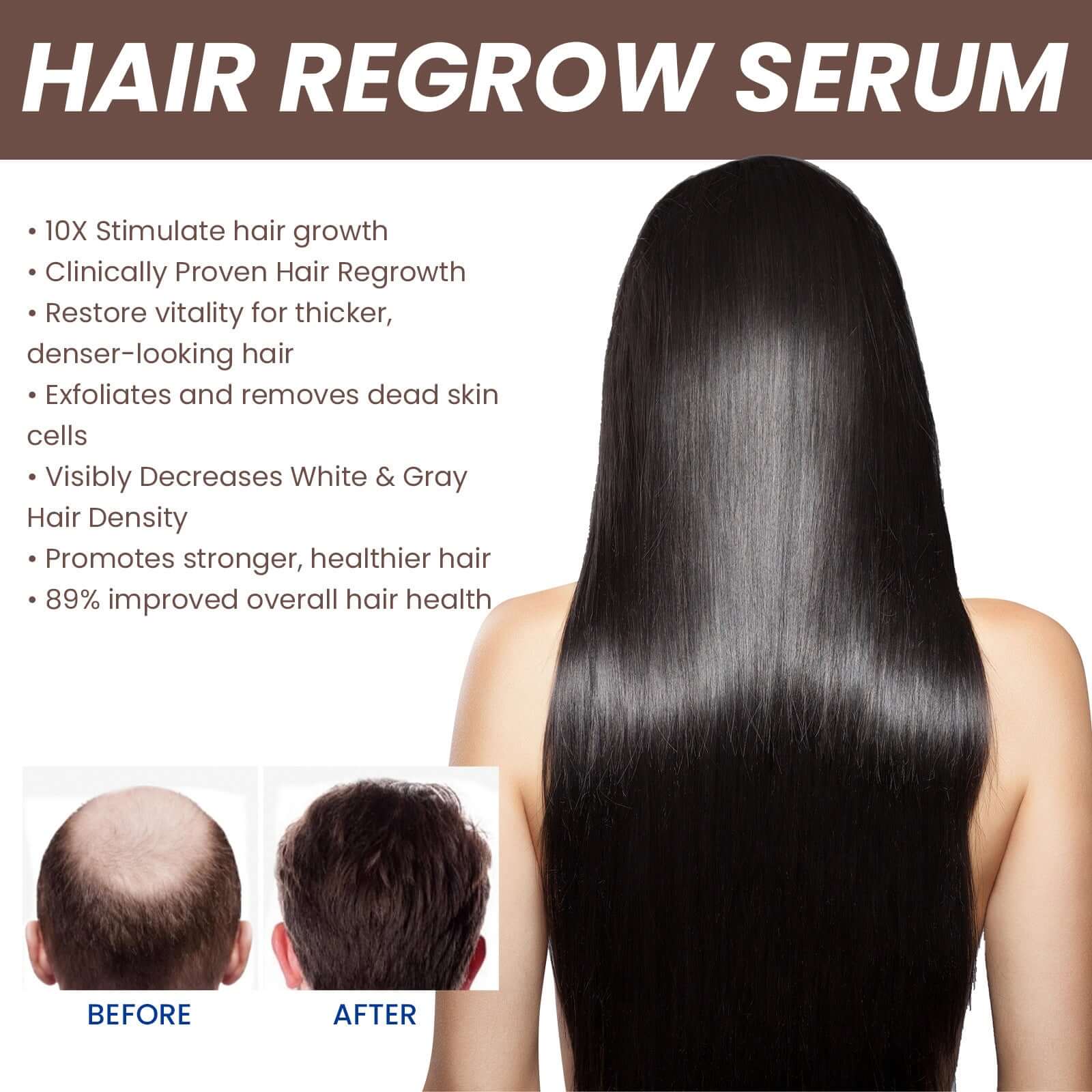 EELHOE Hair Dense Essence Hair Anti-hair Loss And Hair Fixation Nutrition - Novair-product name