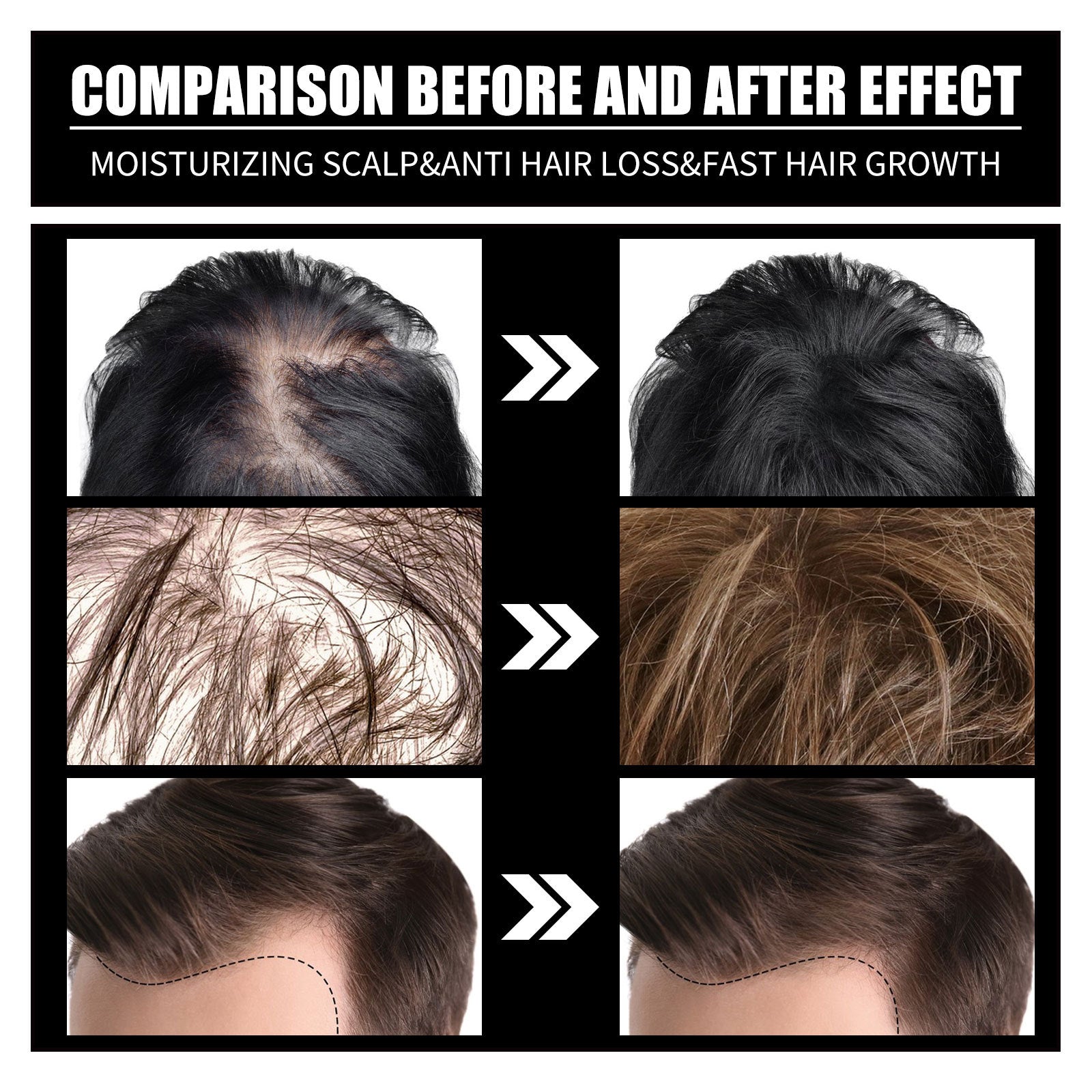 RESEARCH Liquid Biotin & Collagen Hair Growth Drops  - Biotin And Liquid Collagen Supplement For Men & Women - Glowing Skin Support, Healthy Hair & Nail Growth - Novair-product name