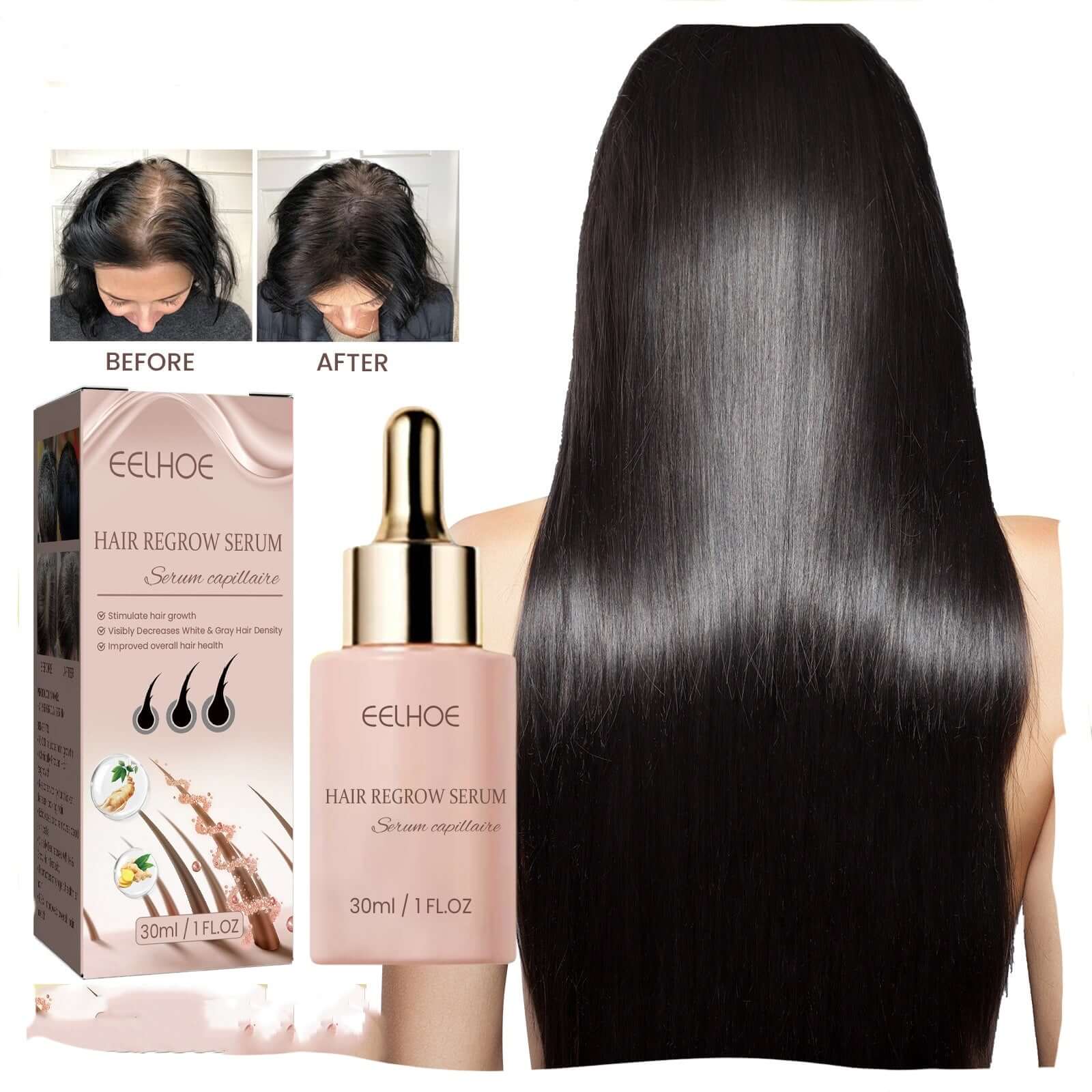 EELHOE Hair Dense Essence Hair Anti-hair Loss And Hair Fixation Nutrition - Novair-product name