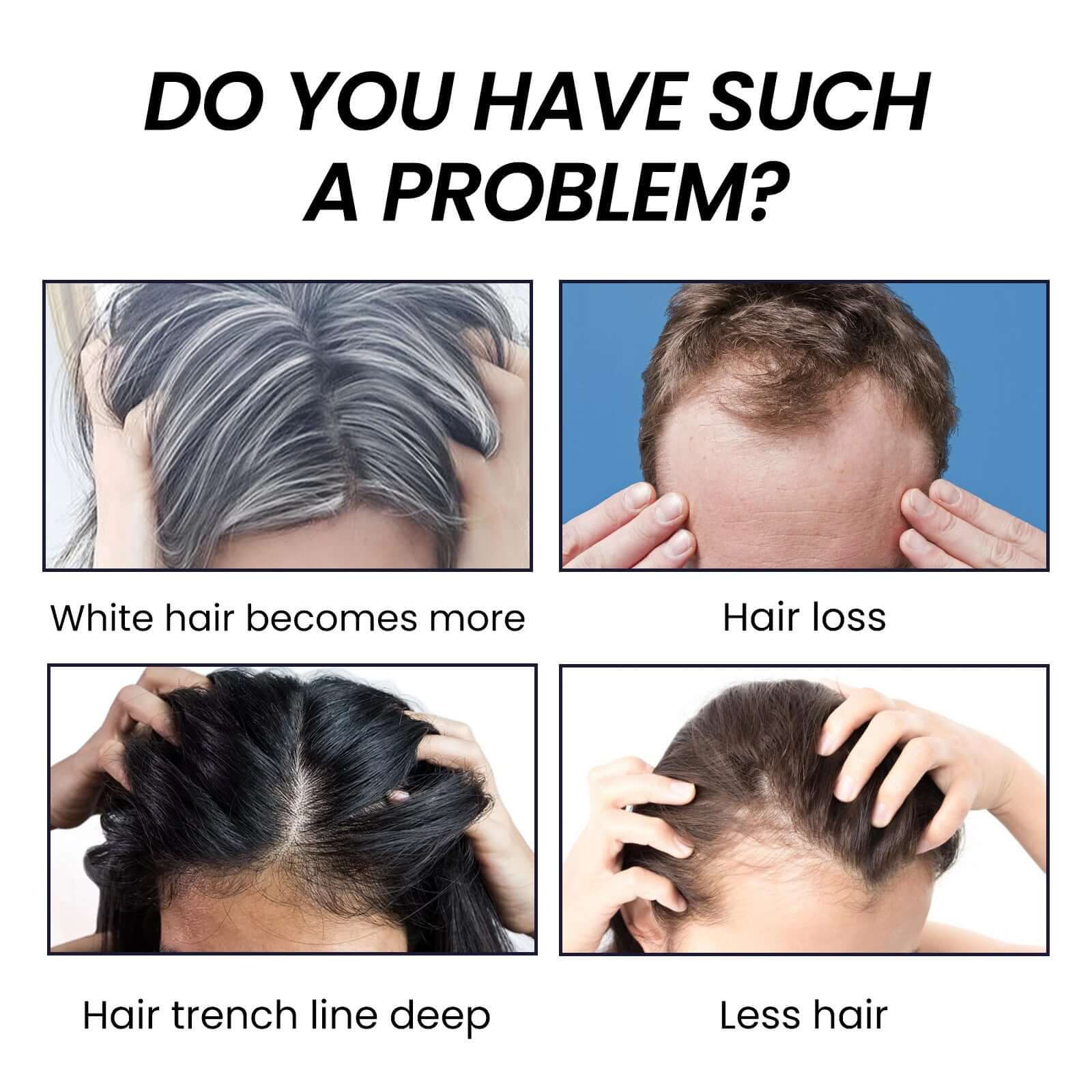EELHOE Hair Dense Essence Hair Anti-hair Loss And Hair Fixation Nutrition - Novair-product name