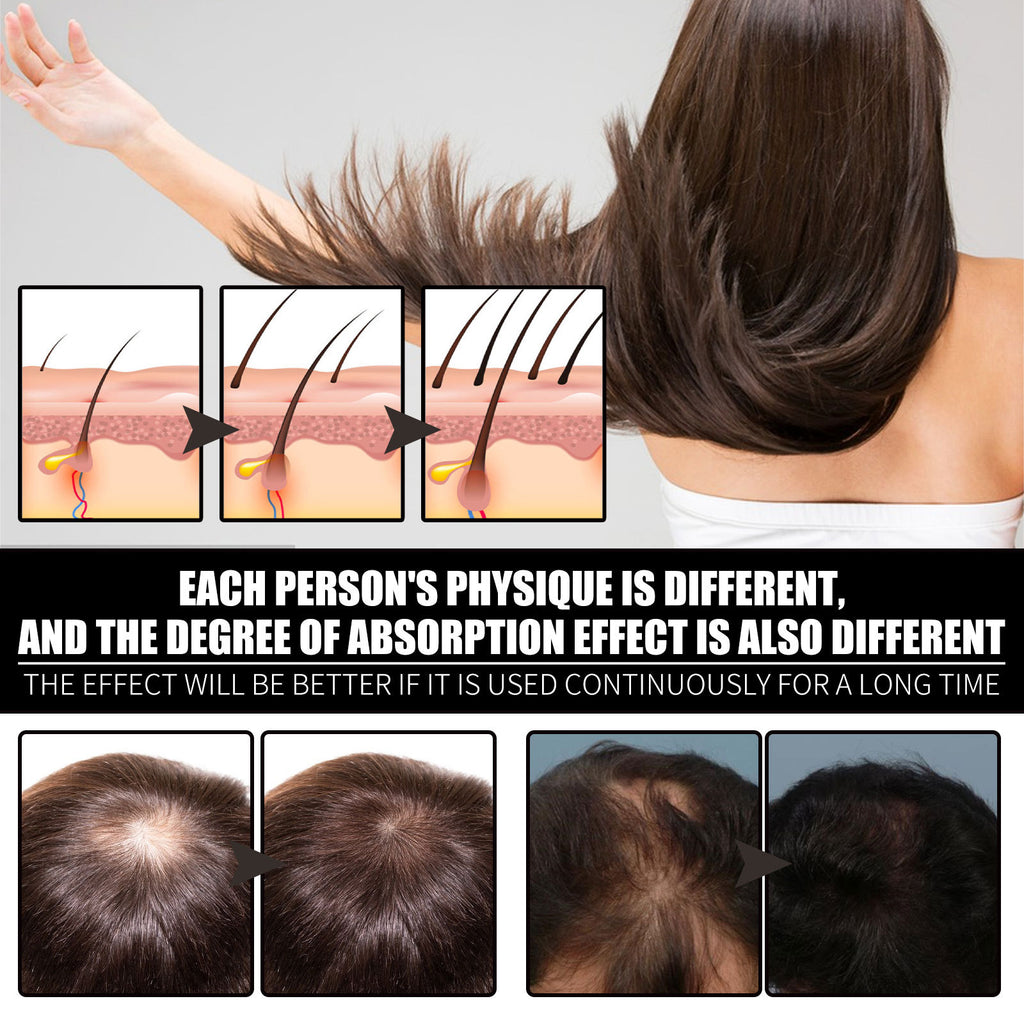 RESEARCH Liquid Biotin & Collagen Hair Growth Drops  - Biotin And Liquid Collagen Supplement For Men & Women - Glowing Skin Support, Healthy Hair & Nail Growth - Novair-product name