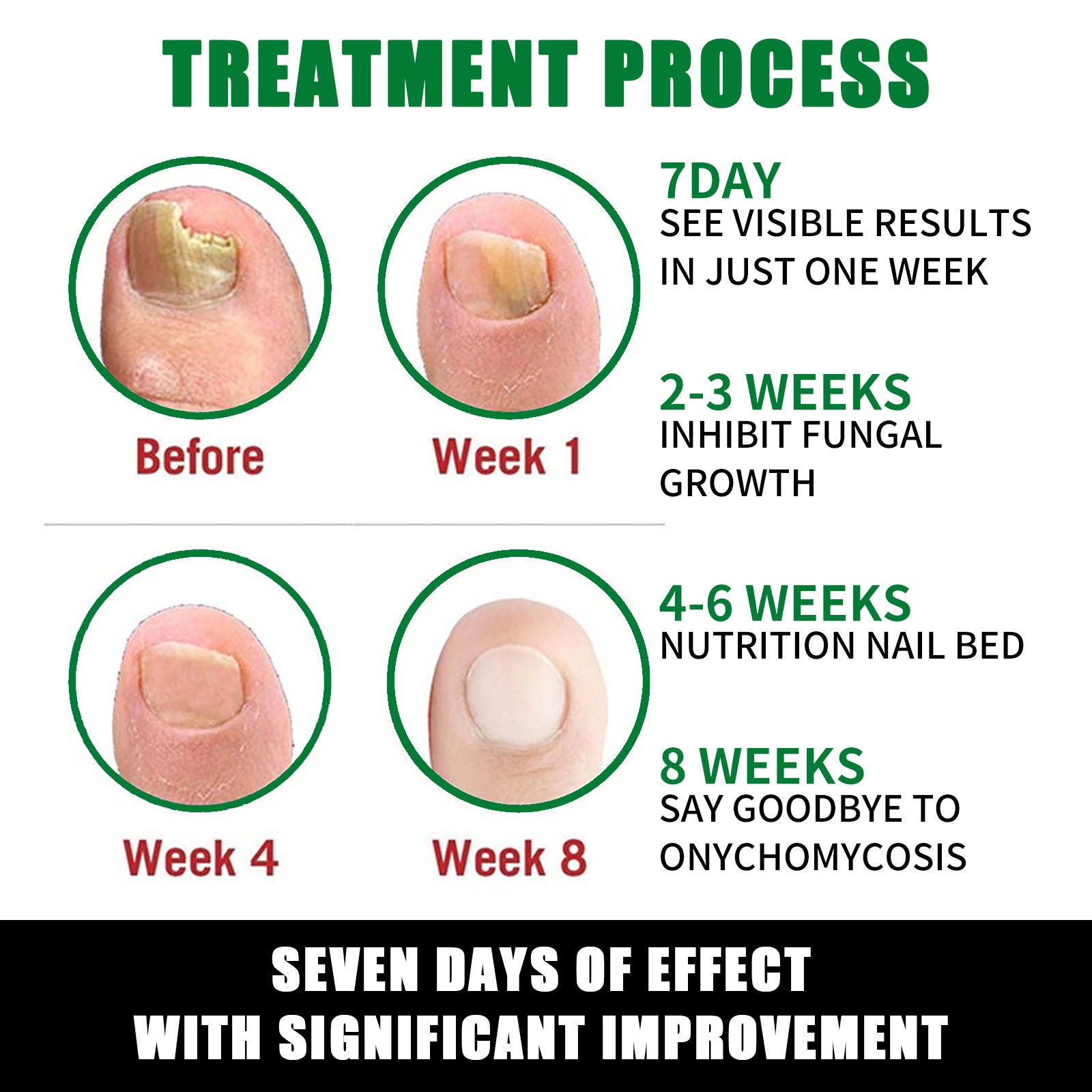 Ginger Nail Care Solution For Soft Nails - Novair-product name