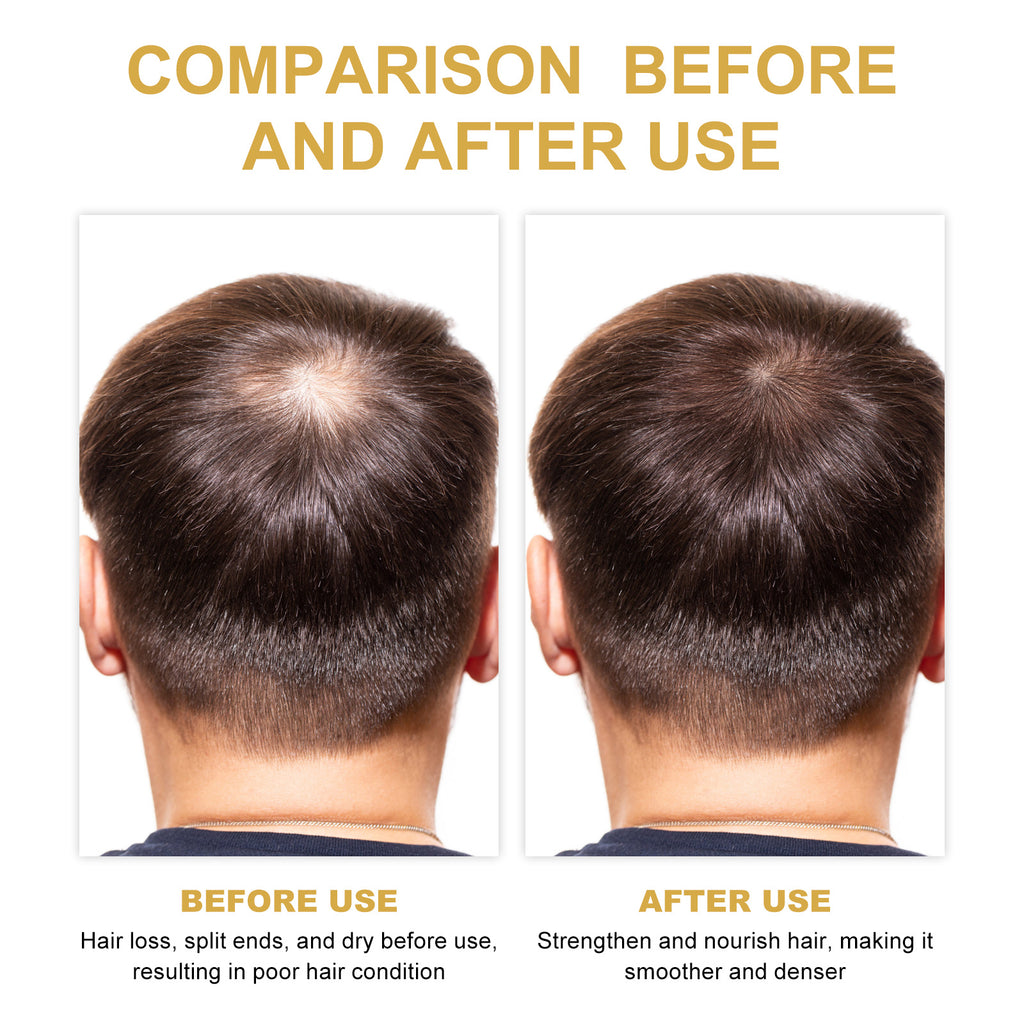 EELHOE Rosemary Hair Treatment Oil Scalp Cleansing Conditioning Volumizing Smoothing Repair Dry Frizzy Hair Conditioning Hair Treatment Oil - Novair-product name