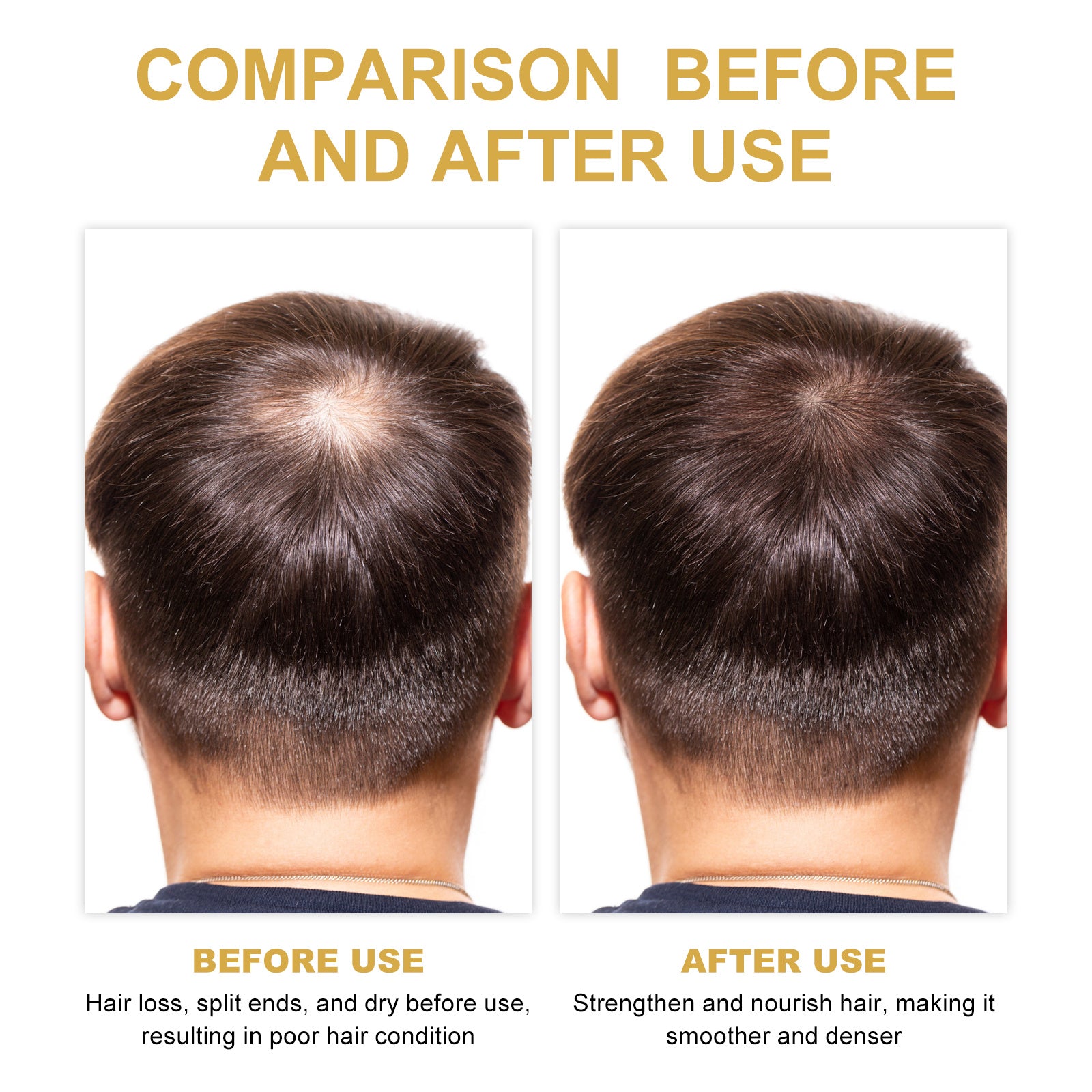 EELHOE Rosemary Hair Treatment Oil Scalp Cleansing Conditioning Volumizing Smoothing Repair Dry Frizzy Hair Conditioning Hair Treatment Oil - Novair-product name